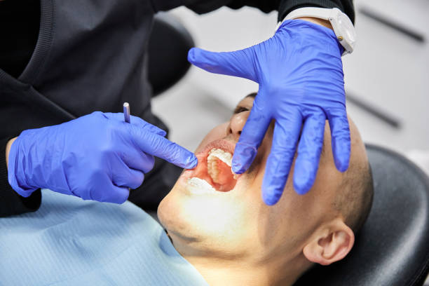 Best Emergency Tooth Extraction in Owasso, OK